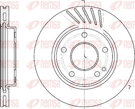 Remsa 6527.10 - Гальмівний диск avtolavka.club